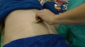 Гуаша Массаж живота