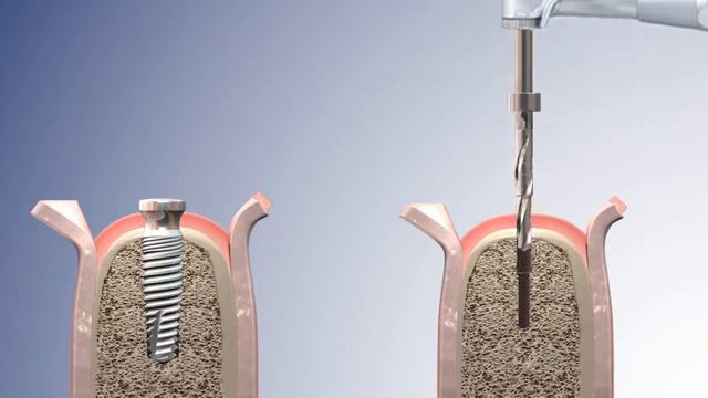 Преимущество ступенчатых сверл Paltop смотреть онлайн