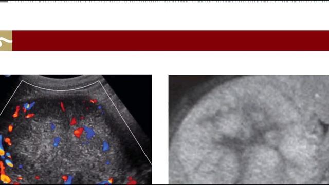 GIT MC GRAW HILL RADIOLOGY BOOKS FRCR(2) смотреть онлайн