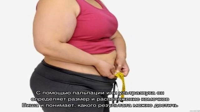 Комки Биша: удаление для коррекции лица