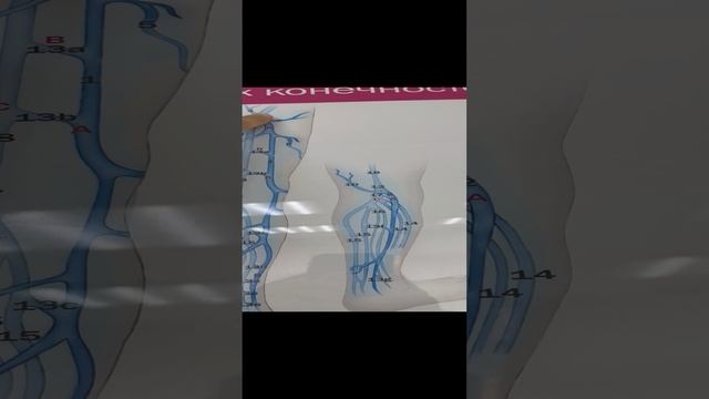 Рецидив варикоза. Как лечить варикоз? Паховый варикоз. Флеболог Москва. Флеболог. Сосудистый хирург смотреть онлайн