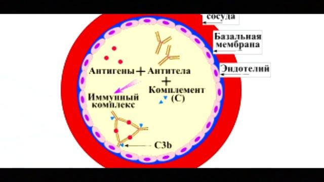 Причины васкулитов смотреть онлайн
