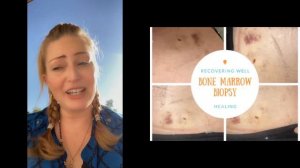 Bone Marrow Biopsy Results Gene Mutations Jak2V617F MPN Polycythemia Vera