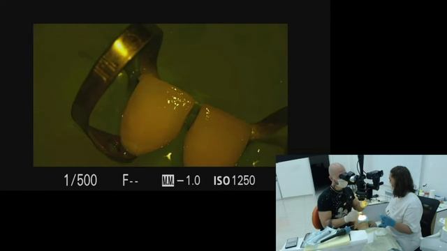 Live-Case.Фронтальные реставрации. Часть 2 смотреть онлайн