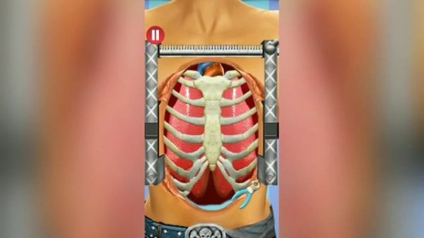 Open Heart Surgery Doctor Game Android Gameplay HD