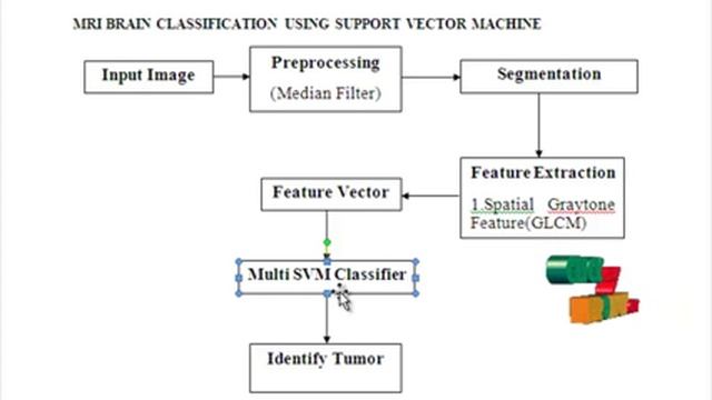 Final Year Projects | MRI BRAIN CLASSIFICATION USING SUPPORT VECTOR MACHINE смотреть онлайн