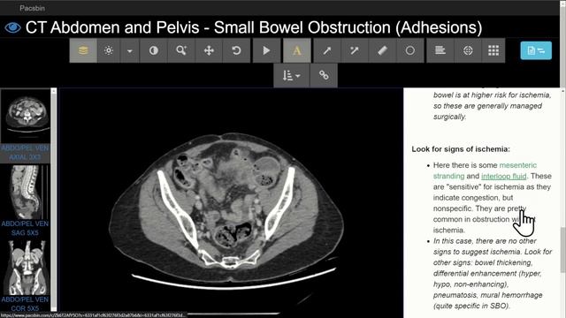 Mastering CT Abdomen and Pelvis: Emergency Course смотреть онлайн