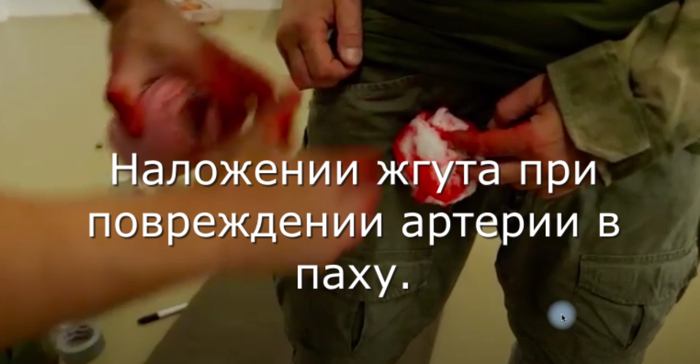 наложение жгута ,пах