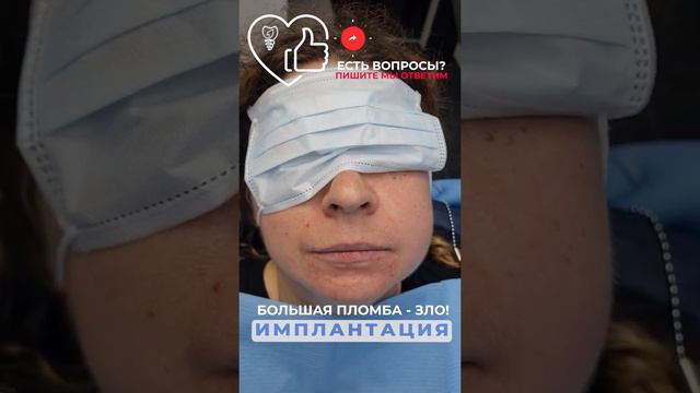 Большая пломба - это зло. смотреть онлайн