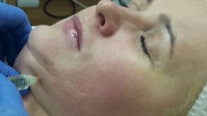 Курс: Кавитация, RF  (разрушение лишнего жира, уплотнение тканей) и Липолитическая Мезотерапия.