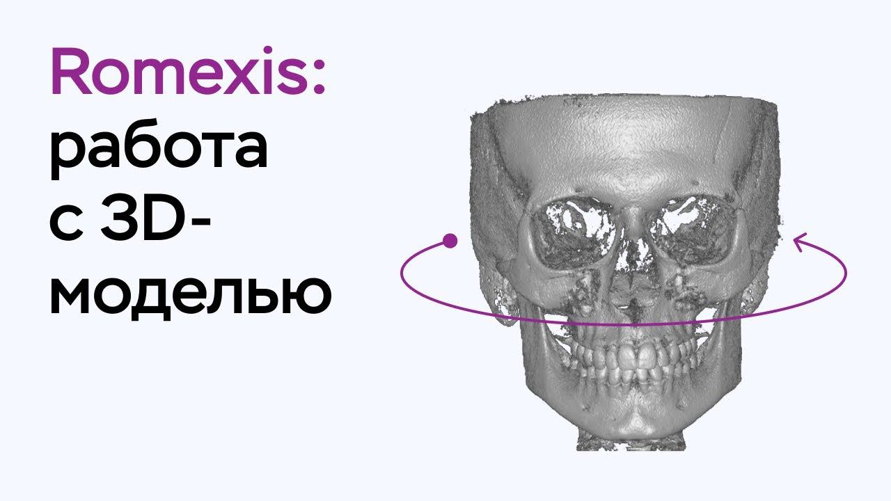 Возможности программы Romexis Viewer: работа с 3D-моделью смотреть онлайн
