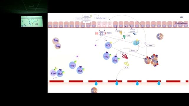 10/09/2018 Eosinophilia and Hypereosinophilic Syndromes смотреть онлайн