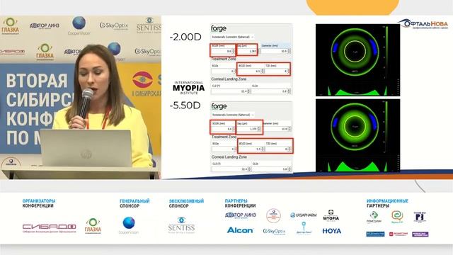 Eye Space – новая эра кастомизированных ортолинз. Невероятная точность без лишних усилий О.М.Селина смотреть онлайн