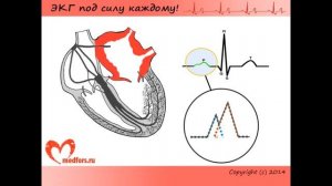 ЭКГ при гипертрофиях различных отделов сердца