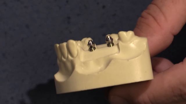 Bridge options for Dental Implants - Conical Connection смотреть онлайн