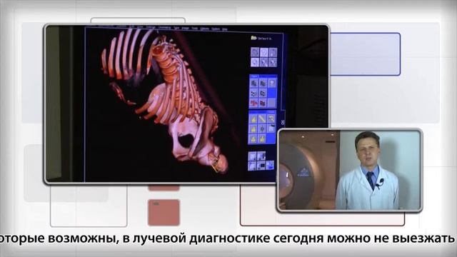 Компьютерная томография 1 смотреть онлайн