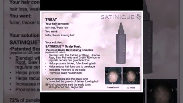 DRY SCALP & HAIR LOSS SOLUTION || AMWAY SATINIQUE HAIR TONIC смотреть онлайн