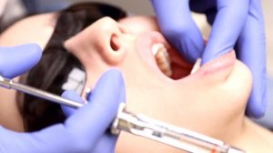 АНЕСТЕЗИЯ В СТОМАТОЛОГИИ (МАНДИБУЛЯРНАЯ, ТОРУСАЛЬНАЯ, ИНФИЛЬТРАЦИОННАЯ)