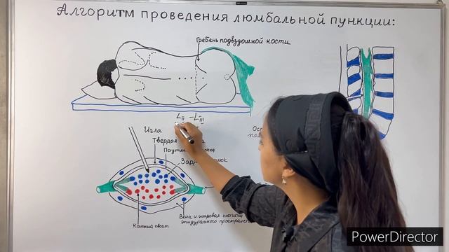 Методика проведения поясничного прокола-lumbar puncture technique. смотреть онлайн
