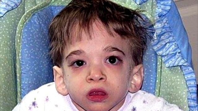 Сколько лет вы дадите этой малышке? Врачи до сих пор не знают, как такое возможно! смотреть онлайн