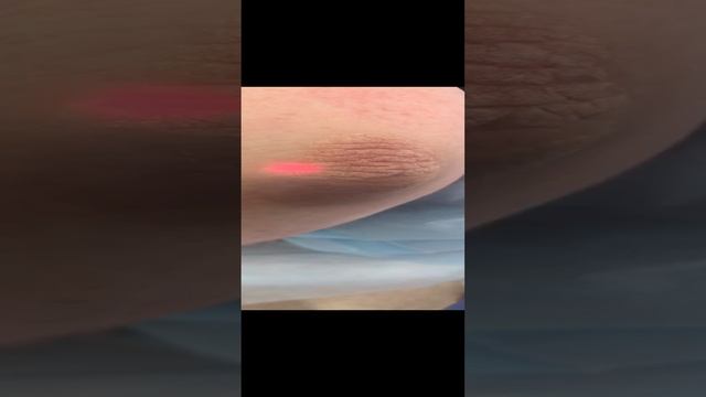 Старые локти???