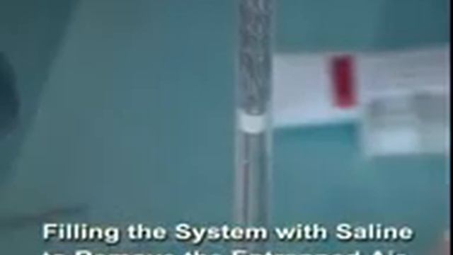 Video Demo of the Bulbar Urethral Stent (BUS) смотреть онлайн