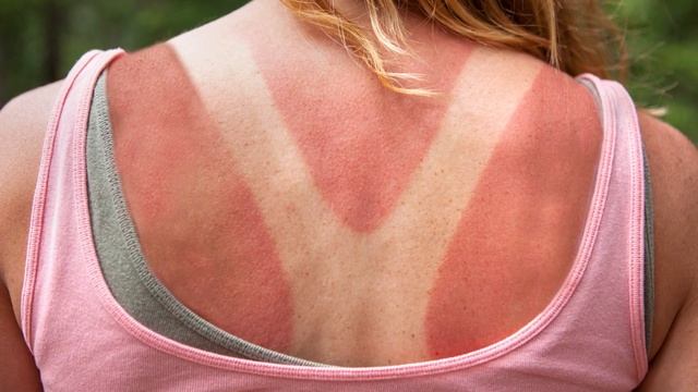 Dənizə gedəndə Günəşdən qorunmaq üçün Bundan Sürtün смотреть онлайн