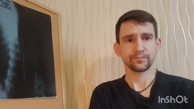 Как долго срастается перелом. Мой перелом ноги зажил за 1,5 месяца. смотреть онлайн