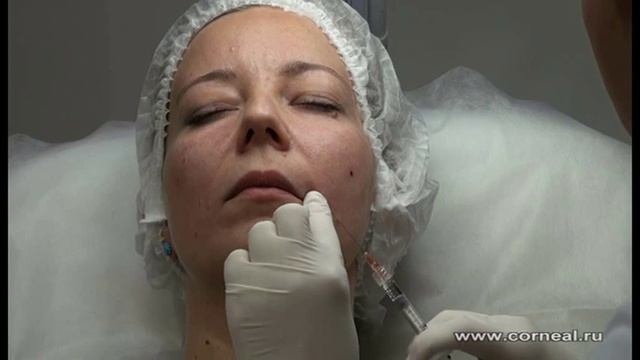 Корректируем канюлей щечки смотреть онлайн
