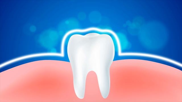 KEIN SCHERZ! Entferne deinen Zahnbelag in 2 Minuten ohne zum Zahnarzt zu gehen! смотреть онлайн