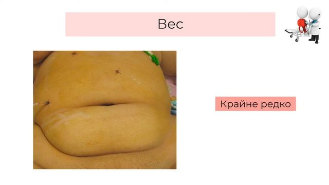 17.10.2020 19:30 «Избранные вопросы хирургии для педиатров» смотреть онлайн