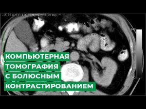 Компьютерная томография с болюсным контрастированием