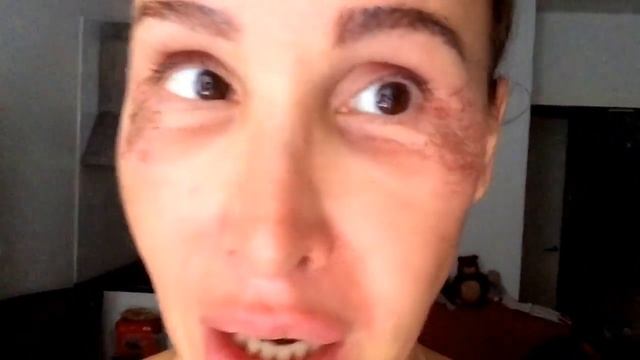 О том как я убирала морщины под глазами второй день, 8, 2017 смотреть онлайн