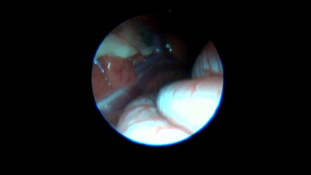 Как работает и как двигается почка птицы во время дыхания. Вальдшнеп. Эндоскопия. смотреть онлайн