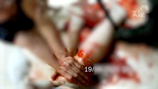 Гомельский ОМОН оказывает медицинскую помощь гомельчанке смотреть онлайн