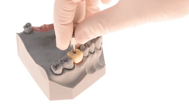 Как работать с системой EZ-base от MIS implants. смотреть онлайн