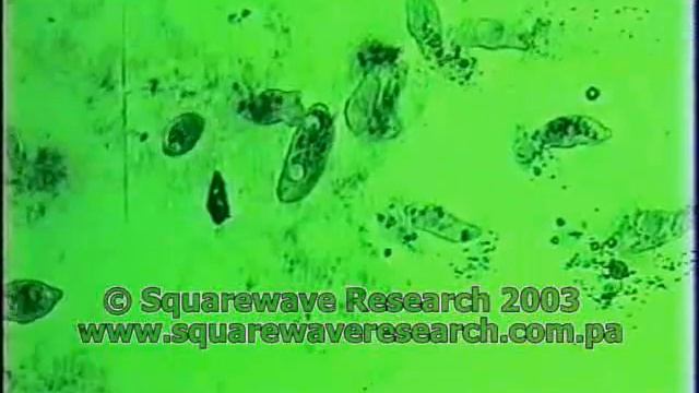 5 ГИБЕЛЬ БАКТЕРИЙ 5 смотреть онлайн