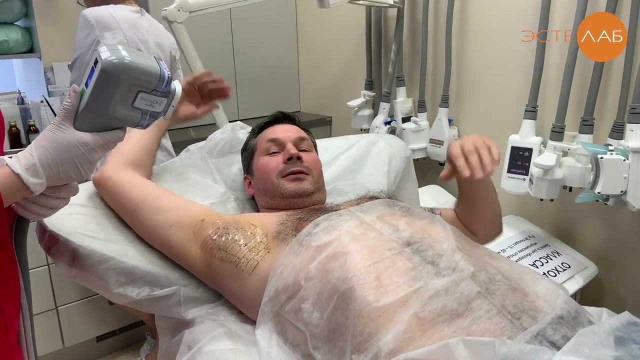 Против пота, запаха и волос в подмышечной области за 1 процедуру смотреть онлайн