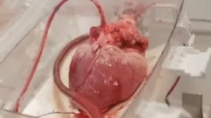 Как бьется сердце человека