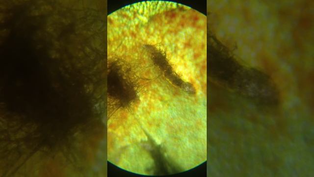 плесень под микроскопом смотреть онлайн