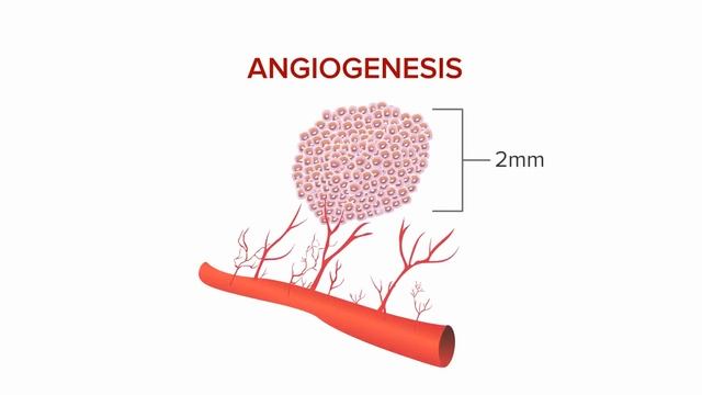 Antiangiogenic Treatments for Metastatic Colorectal Cancer смотреть онлайн
