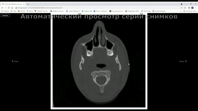 Project SkiaAtlas MVP 1