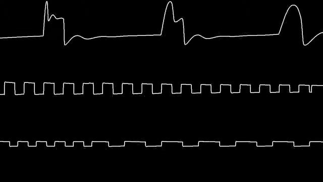 c64 spellbound Sid Oscilloscope view - Author : Rob Hubbard смотреть онлайн