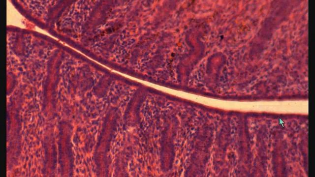МАТКА гистологическое строение UTERUS смотреть онлайн