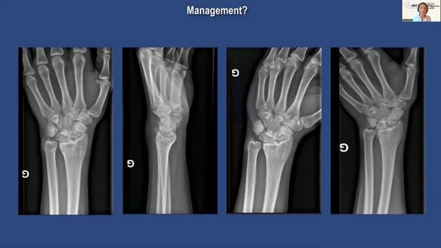 IWC CLINICAL CASES SYMPOSIUM SESSION 1 JANUARY 2023 смотреть онлайн