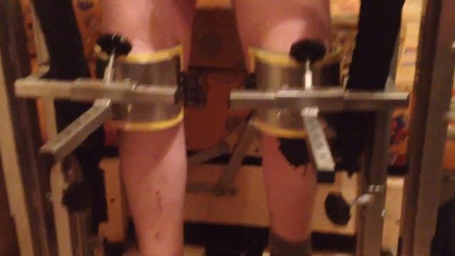 Реабилитолог Юрий Жидченко. Реабилитация на дому после удаления опухоли спинного мозга. 