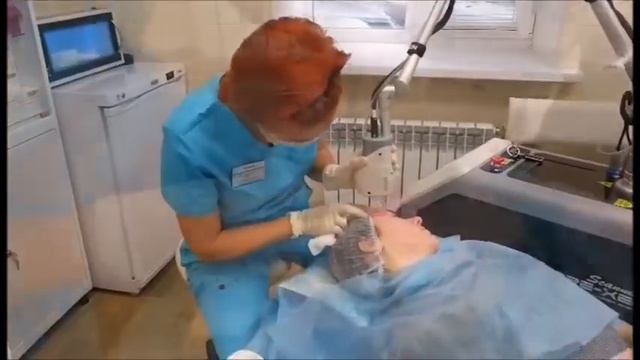 Лазерный фракционный пилинг (шлифовка) СО2 лазер. Курск. смотреть онлайн