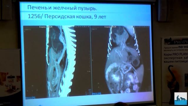 Компьютерная томография органов брюшной полости смотреть онлайн