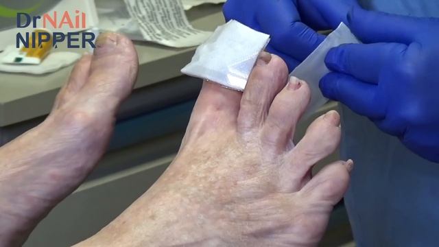 What is Dr Nail Nipper working on? Big Toenail (2020) смотреть онлайн