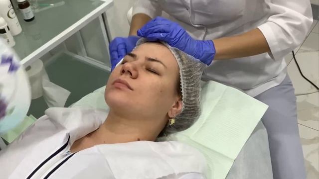 Как проходит ПИЛИНГ ЛИЦА У КОСМЕТОЛОГА ✅ Этапы ПИЛИНГА ❤️ Эффект от ПИЛИНГА ЛИЦА ❤️? смотреть онлайн
